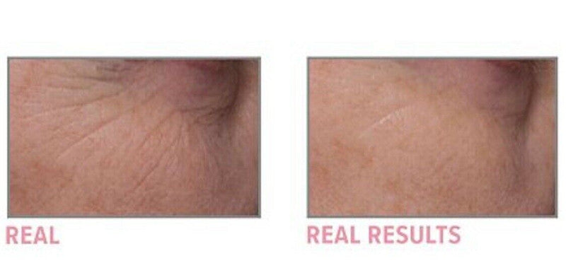 HydraSmooth Anti-Wrinkle Cream
